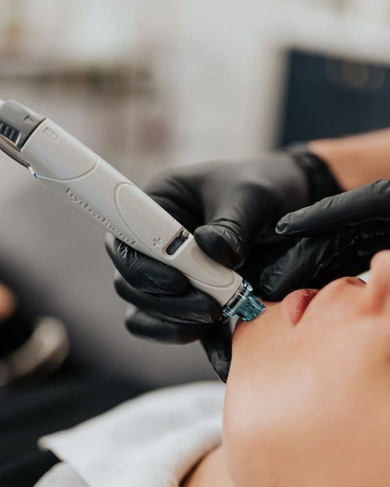 Huidverbetering – Hydrafacial